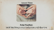 
	COMPLICATIONS IN PREGNANCY
	Aborting One Life to Save Another
	
	Couples undergoing fertility treatment are often advised to reduce the number of fetuses in order to save a high-risk pregnancy. May we end the life of one or two to save the lives of many? Is the fetus considered a life? This lesson discusses Judaism’s view on the status of the fetus, and the ethics of choosing one life over another.